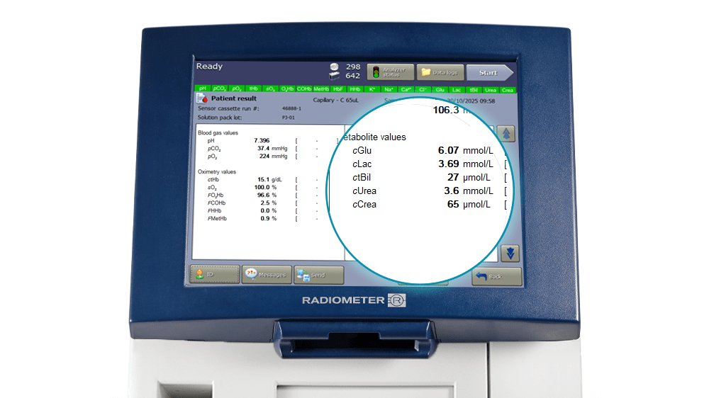 Crea urea on the ABL90 FLEX PLUS analyzer